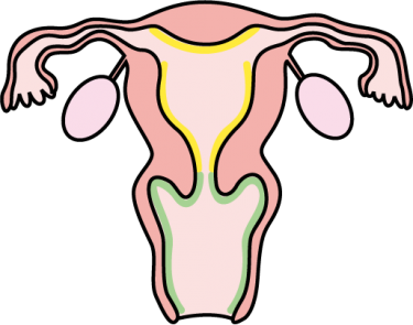 宮内膜スクラッチと抗生物質：重複子宮と妊娠
